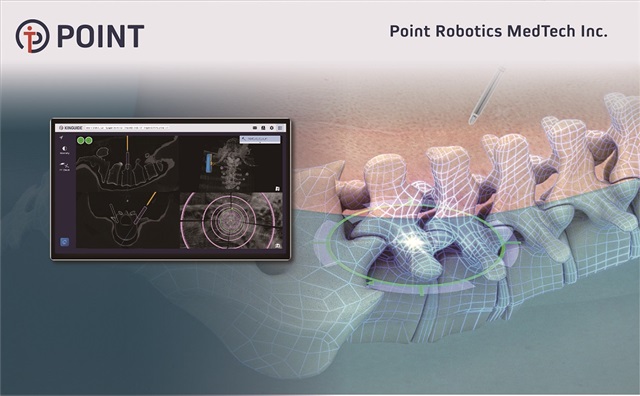 Point Robotics’ robotic-assisted surgical system and navigation system