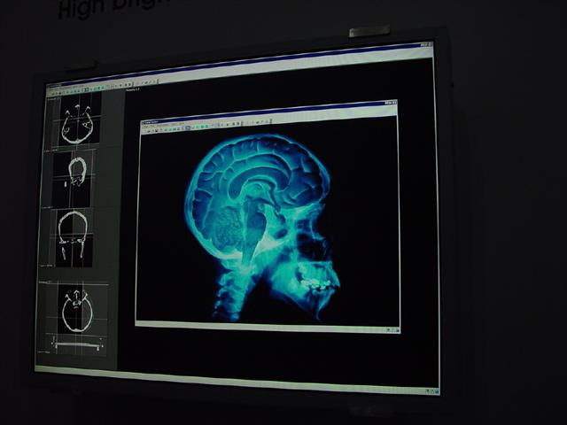 LG.Philips LCD develops 20.8-inch medical panel